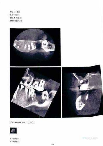 記念品のレントゲン写真