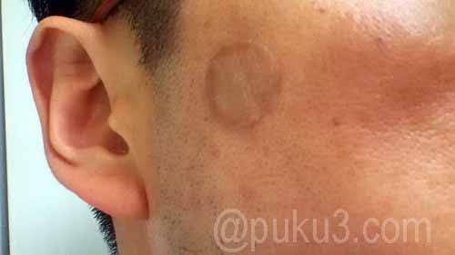 被覆材を貼って2週間！